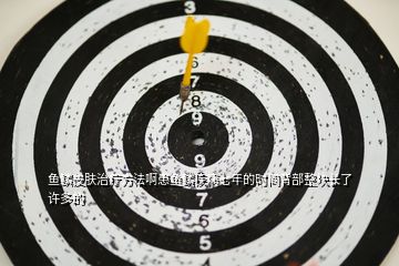 魚(yú)鱗皮膚治療方法啊患魚(yú)鱗疾病七年的時(shí)間背部整塊長(zhǎng)了許多的
